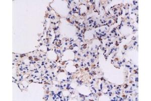 Immunohistochemistry (Paraffin-embedded Sections) (IHC (p)) image for anti-Interferon gamma (IFNG) (AA 75-155) antibody (ABIN669126)