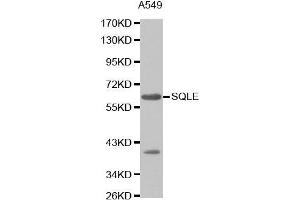 Western Blotting (WB) image for anti-Squalene Epoxidase (SQLE) (AA 143-400) antibody (ABIN1513563) (SQLE Antikörper  (AA 143-400))