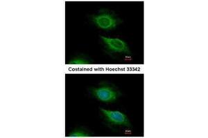 ICC/IF Image Immunofluorescence analysis of methanol-fixed HeLa, using ARF5, antibody at 1:500 dilution. (ARF5 Antikörper)
