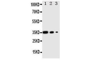 Western Blotting (WB) image for anti-Wingless-Type MMTV Integration Site Family, Member 2B (WNT2B) (AA 169-185), (Middle Region) antibody (ABIN3042967)