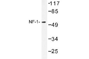 Image no. 1 for anti-Nuclear Factor I/A (NFIA) antibody (ABIN272219) (NFIA Antikörper)