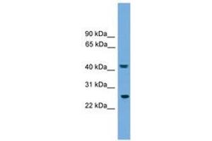 Image no. 1 for anti-RAB35, Member RAS Oncogene Family (RAB35) (AA 71-120) antibody (ABIN6744956) (RAB35 Antikörper  (AA 71-120))