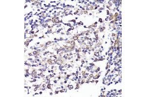Immunohistochemistry of paraffin-embedded human tonsil using SELL antibody (ABIN3022263, ABIN3022264, ABIN3022265 and ABIN6218704) at dilution of 1:100 (40x lens). (L-Selectin Antikörper  (AA 1-100))