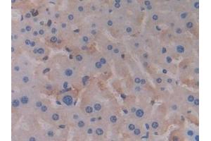Immunohistochemistry (IHC) image for anti-Pyruvate Dehydrogenase Kinase, Isozyme 4 (PDK4) (AA 117-387) antibody (ABIN7439630)