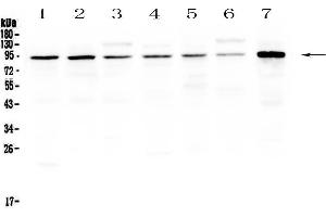 Western blot analysis of SAE2/UBA2 using anti-SAE2/UBA2 antibody .