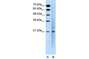 MUC1 antibody used at 0. (MUC1 Antikörper  (C-Term))