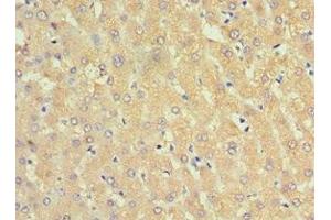 Immunohistochemistry of paraffin-embedded human liver tissue using ABIN7143754 at dilution of 1:100 (SERPINA3 Antikörper  (AA 24-423))