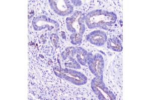IHC analysis of LATS1 using anti-LATS1 antibody (ABIN6719580).