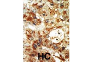 Immunohistochemistry (IHC) image for anti-Mitogen-Activated Protein Kinase 12 (MAPK12) antibody (ABIN5023083) (MAPK12 Antikörper)