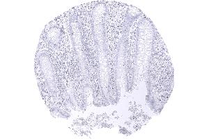 TFE3 staining is lacking in epithelial cells of the appendix