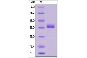 Human Prolactin R, His Tag on  under reducing (R) condition. (Prolactin Receptor Protein (PRLR) (AA 25-234) (His tag))