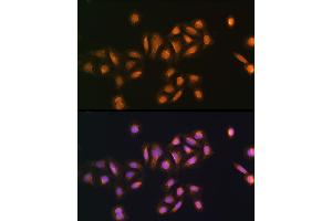 Immunofluorescence analysis of U2OS cells using STK38 antibody (ABIN6132692, ABIN6148616, ABIN6148617 and ABIN6224215) at dilution of 1:100. (STK38 Antikörper  (AA 1-200))