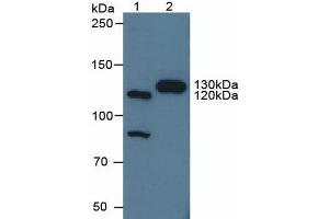 Western blot analysis of (1) Human HeLa cells and (2) Porcine Brain Tissue. (Contactin 4 Antikörper  (AA 731-980))