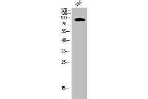 Western Blot analysis of VEC cells using Cleaved-COL1A2 (G1102) Polyclonal Antibody (COL1A2 Antikörper  (Cleaved-Gly1102))