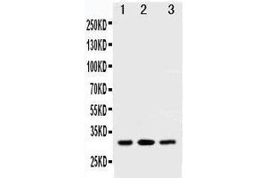 Anti-SDHB antibody, Western blotting All lanes: Anti SDHB  at 0. (SDHB Antikörper  (N-Term))