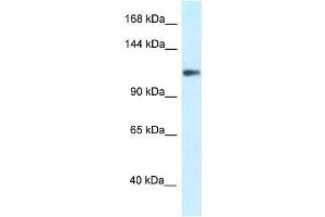 Western Blot showing KCNH3 antibody used at a concentration of 1. (KCNH3 Antikörper  (N-Term))