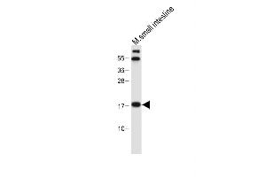 Anti-NUDT15 Antibody (C-term) at 1:500 dilution + Mouse small intestine tissue lysate Lysates/proteins at 20 μg per lane.