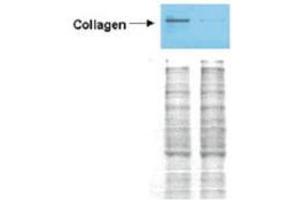 Western Blot of Rabbit anti-Collagen I antibody. (Collagen Type I Antikörper  (FITC))