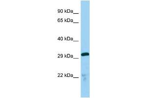 Host:  Rabbit  Target Name:  Tmx2  Sample Type:  Mouse Lung lysates  Antibody Dilution:  1. (TMX2 Antikörper  (C-Term))