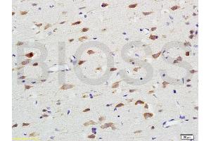 Formalin-fixed and paraffin embedded rat brain labeled with Anti-Nox4/NADH Polyclonal Antibody, Unconjugated (ABIN737526) at 1:200 followed by conjugation to the secondary antibody and DAB staining. (NADPH Oxidase 4 Antikörper  (AA 81-180))