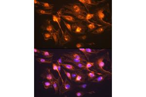 Immunofluorescence (IF) image for anti-Synaptophysin (SYP) (AA 150-250) antibody (ABIN6148783)