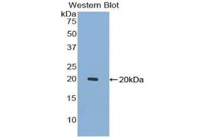 Western blot analysis of the recombinant protein. (GDF7 Antikörper  (AA 295-447))