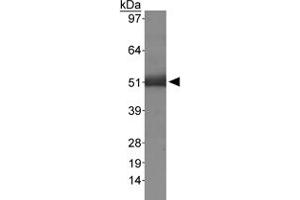 Western blot analysis of MSR1 in human liver using MSR1 polyclonal antibody . (Macrophage Scavenger Receptor 1 Antikörper  (AA 300-400))