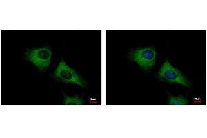 ICC/IF Image SCARA3 antibody [N2C2], Internal detects SCARA3 protein at cytoplasm by immunofluorescent analysis. (SCARA3 Antikörper)