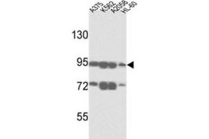 Western Blotting (WB) image for anti-ATP-Binding Cassette, Sub-Family B (MDR/TAP), Member 5 (ABCB5) antibody (ABIN3002513) (ABCB5 Antikörper)