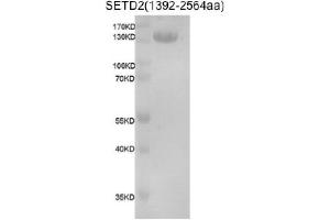 Recombinant SETD2 (1392-2564) protein gel. (SETD2 Protein (DYKDDDDK Tag))