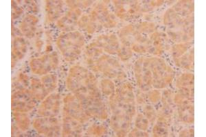 Figure. (TPSAB1 Antikörper  (AA 161-262))