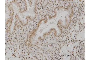 Immunoperoxidase of monoclonal antibody to SCML1 on formalin-fixed paraffin-embedded human endometrium. (SCML1 Antikörper  (AA 3-100))