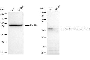 Western blotting analysis using Prolyl 4-hydroxylase subunit beta antibody (ABIN7799920).