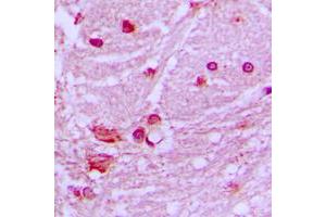 Immunohistochemical analysis of DNAL1 staining in human brain formalin fixed paraffin embedded tissue section.