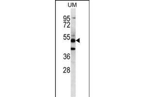 PNLIPRP3 Antibody (N-term) (ABIN656711 and ABIN2845941) western blot analysis in uterus tumor cell line lysates (35 μg/lane). (PNLIPRP3 Antikörper  (N-Term))