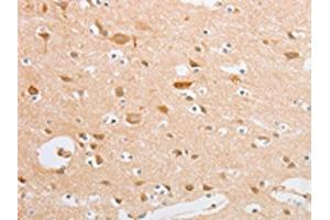 The image on the left is immunohistochemistry of paraffin-embedded Human brain tissue using ABIN7131039(SERPINE2 Antibody) at dilution 1/20, on the right is treated with fusion protein. (SERPINE2 Antikörper)