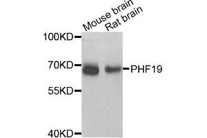 Western blot analysis of extracts of various cells, using PHF19 antibody. (PHF19 Antikörper)