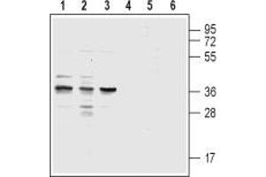 Western blot analysis of acute monocytic leukemia THP-1 (lanes 1 and 4), promyelocytic leukemia HL-60 (lanes 2 and 5) and acute T-cell leukemia Jurkat (lanes 3 and 6) human cell lysates: - 1,2,3. (CysLTR1 Antikörper  (3rd Extracellular Loop))