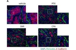 Immunofluorescence (Paraffin-embedded Sections) (IF (p)) image for anti-Periostin (POSTN) (C-Term) antibody (ABIN2854805)