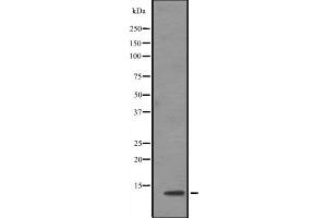 Western Blotting (WB) image for anti-Transcription Elongation Factor B (SIII), Polypeptide 1 (15kDa, Elongin C) (TCEB1) (N-Term) antibody (ABIN6258776)