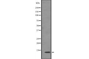 Western blot analysis of TCEB1 expression in Jurkat cell line lysates ,The lane on the left is treated with the antigen-specific peptide. (TCEB1 Antikörper  (N-Term))