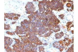 Formalin-fixed, paraffin-embedded human Parathyroid stained with PTH Monoclonal Antibody (PTH/1174). (PTH Antikörper  (AA 32-115))