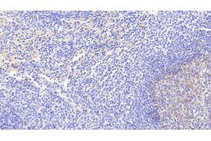 Detection of VCAM1 in Rabbit Spleen Tissue using Monoclonal Antibody to Vascular Cell Adhesion Molecule 1 (VCAM1) (VCAM1 Antikörper  (AA 409-682))