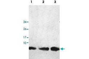 Western blot analysis of human fetal kidney (Lane 1), fetal liver (Lane 2) and fetal heart (Lane 3) lysate with HHLA3 polyclonal antibody  at 1 : 1000 dilution. (HHLA3 Antikörper  (AA 1-122))