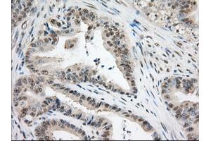 Image no. 10 for anti-Transforming, Acidic Coiled-Coil Containing Protein 3 (TACC3) antibody (ABIN1498097) (TACC3 Antikörper)