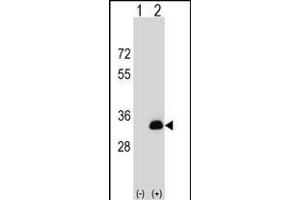 Western blot analysis of DOK5 (arrow) using rabbit polyclonal DOK5 Antibody (N-term) (ABIN1539174 and ABIN2848803). (DOK5 Antikörper  (N-Term))