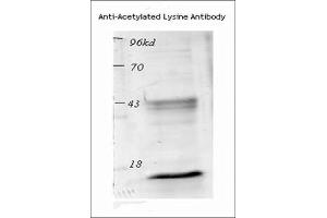 Western blot analysis of Mouse Spleen lysates showing detection of Acetylated Lysine protein using Rabbit Anti-Acetylated Lysine Polyclonal Antibody . (Lysine (lys) (acetylated) Antikörper (HRP))
