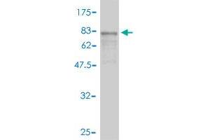 Western Blot detection against Immunogen (70. (Aminoacylase 1 Antikörper  (AA 1-408))