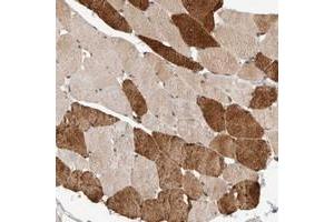 Immunohistochemical staining of human skeletal muscle with SYDE2 polyclonal antibody  shows strong cytoplasmic positivity in subsets of muscle fibers at 1:50-1:200 dilution. (SYDE2 Antikörper)