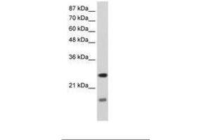 Image no. 2 for anti-Signal Recognition Particle 14kDa (Homologous Alu RNA Binding Protein) (SRP14) (AA 38-87) antibody (ABIN202027) (SRP14 Antikörper  (AA 38-87))